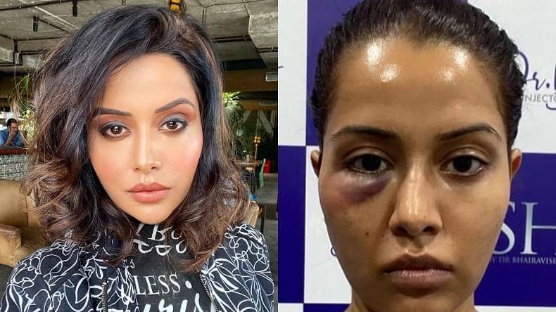 بھارتی اداکارہ کے فیشیل ٹریٹمنٹ نے چہرہ بگاڑ دیا، پہچاننا مشکل