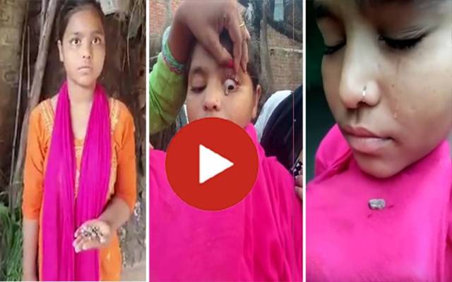 لڑکی کی اٰنکھ سے پھتر نکل آئے