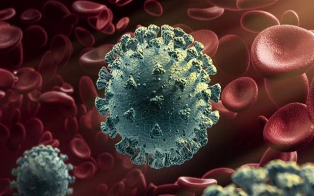 نیوزی لینڈ، عالمی وبا کورونا وائرس، ویکسین فائزر، شہری کی موت