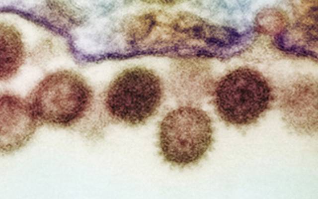کانگو وائرس ، وبا پھوٹ پڑی