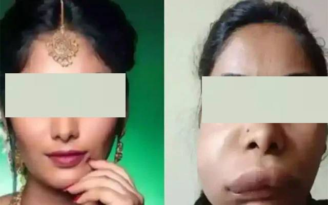  ڈاکٹروں کی لاپرواہی۔بھارتی اداکارہ کا چہرہ بگاڑ دیا