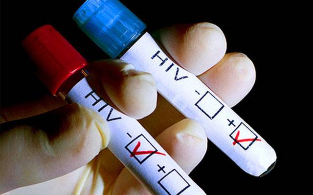 ملک بھر میں ایڈز کے مریضوں میں حیرت انگیز اضافہ