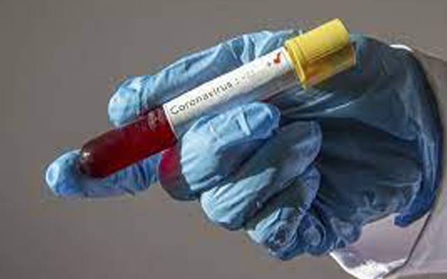 بلوچستان کے 4 اضلاع میں کورونا وائرس کے ٹیسٹ 109 ٹیسٹ، 1 کیس رپورٹ