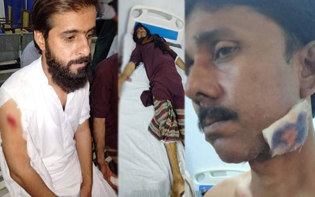 شہدادکوٹ میں  آوارہ کتوں نے 14 افراد کو کاٹ لیا