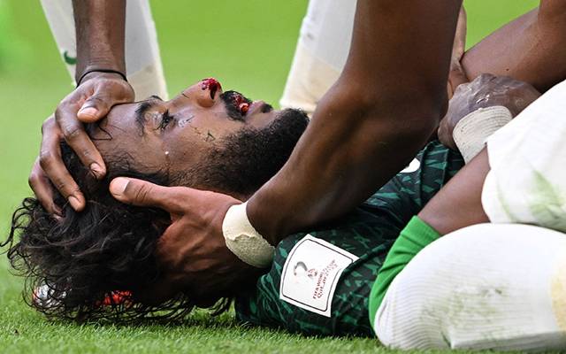 ارجنٹائن کے ساتھ میچ کے دوران سعودی کھلاڑی کا جبڑا ٹوٹ گیا