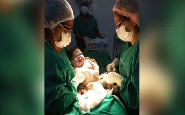 برازیل میں سوا سات کلو وزنی بچے کی پیدائش