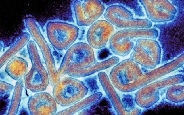 یواے ای کاخطرناک ماربرگ وائرس سے متعلق پھر انتباہ، شہریوں کو سفر سے گریز کی ہدایت