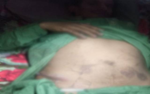 راولپنڈی:ذہنی معذور لڑکے  کے اغوا اور گردے نکالنے کا انکشاف 