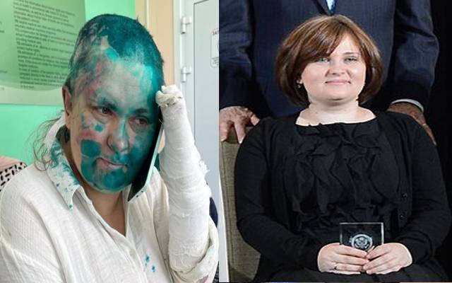  روسی خاتون صحافی پر بہیمانہ تشدد، انگلیاں اور بال کاٹ دیئے گئے, ہسپتال منتقل