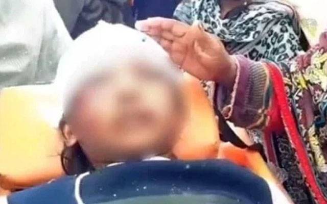 شدید  تشدد کا نشانہ بننے والی گھریلو ملازمہ رضوانہ کی طبیعت  کے حوالے سے جنرل اسپتال لاہور کے پرنسپل ڈاکٹر الفرید ظفر کا کہنا تھا کہ رضوانہ کو  صبح سے آکسیجن لگی ہوئی ہے جس کے بعداس کی حالت میں کچھ  بہتری ہے