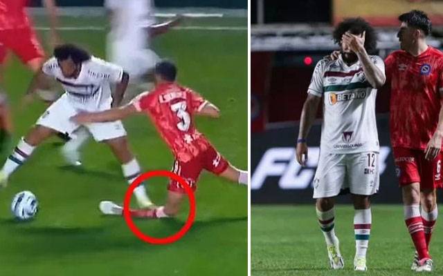  برازیلین کھلاڑی کی ٹکر سے ارجنٹائن کے فٹبالر کی ٹانگ ٹوٹ گئی، وائرل ویڈیو