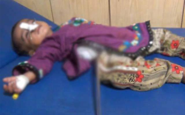 صادق آباد،10ماہ کی بچی کے آپریشن کے دوران پیٹ سے بچہ نکل آیا