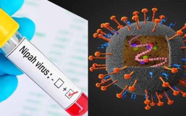 پاکستان میں ’نپاہ‘ وائرس کے پھیلنے کا خطرہ، محکمہ صحت سندھ کی ایڈوائزری جاری
