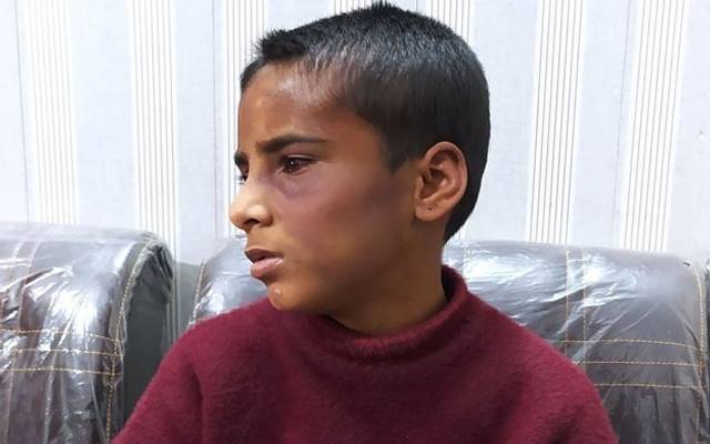 لاہور کے علاقے جوہر ٹاؤن میں کمسن گھریلو ملازمہ کو مبینہ طور پر تشدد کا نشانہ بنانے والے میاں بیوی کو پولیس نے گرفتار کرلیا۔