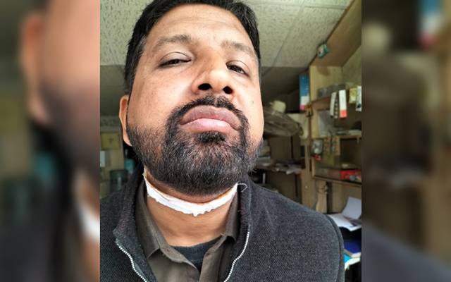 اسلام آباد میں پولیس کی تمام کوششوں کے باوجود گڈی اور ڈور کی فروخت نہ رک سکی۔ پتنگ بازی کے دوران گردن پر ڈور پھرنے سے باپ بیٹا زخمی ہوگئے۔