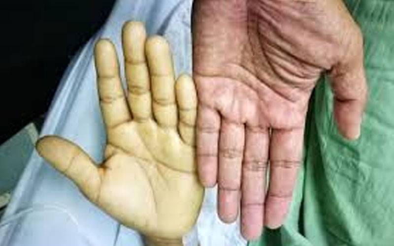 خون کی کمی دور کرنے کیلئے بہترین غذائیں