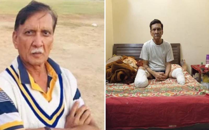  سابق کرکٹر اور کوچ مہندر کمار کے پاؤں میں زخم، ٹانگیں کاٹ دی گئیں