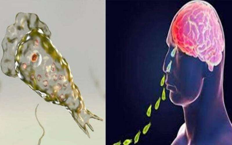 موذی مرض نیگلیریا سے ایک اور نوجوان اسپتال میں دم توڑ گیا