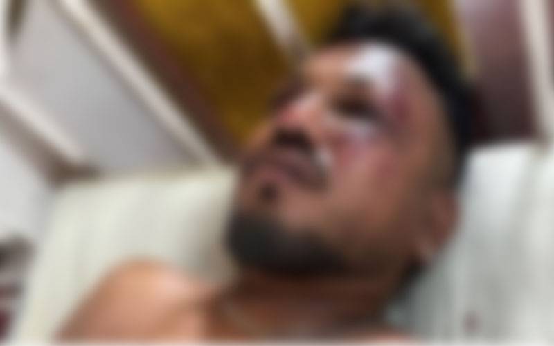 طیارہ حادثہ میں ایک مسافر معجزانہ طور پر بچ گیا