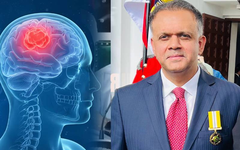 بروقت تشخیص اورعلاج سے دماغ کی رسولیوں کا علاج ممکن:پروفیسر آصف بشیر 
