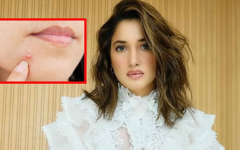اپنا تھوک لگائیں ،کیل مہاسے ختم : تمنا بھاٹیہ 