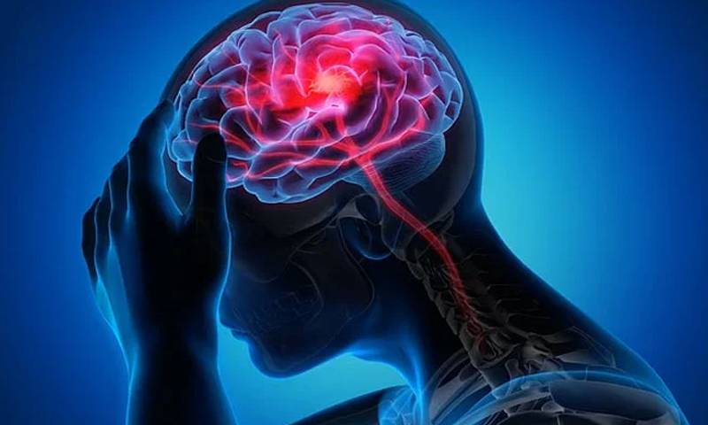 دوران حمل پیچیدگیاں خواتین میں فالج کا امکان بڑھا سکتی ہیں: تحقیق