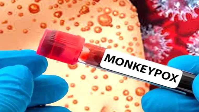 لاہور شہر میں منکی پاکس کا خطرہ،مریض کی تصدیق، آئسولیشن میں زیر علاج 
