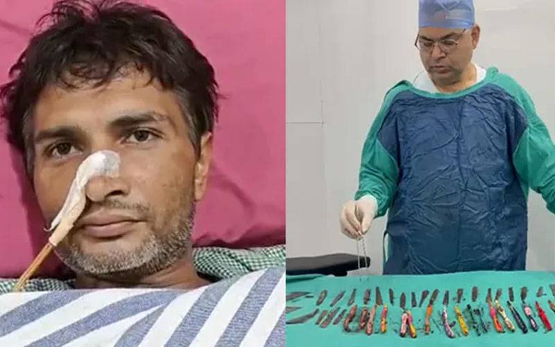 بھارت میں ڈاکٹروں نے مریض کے معدے سے 29 چمچ ،19 ٹوتھ برش اور قلم نکال لئے 