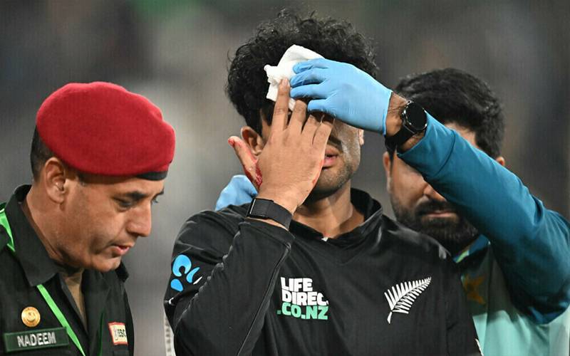 نیوزی لینڈ کے راچن رویندرا چہرے پر چوٹ لگنے سے زخمی ہو گئے 