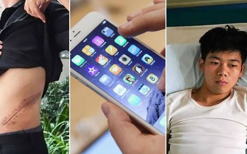 آئی فون خریدنے کیلئےگردہ بیچنے والا شخص زندگی بھر کا روگ لگو ا بیٹھا 