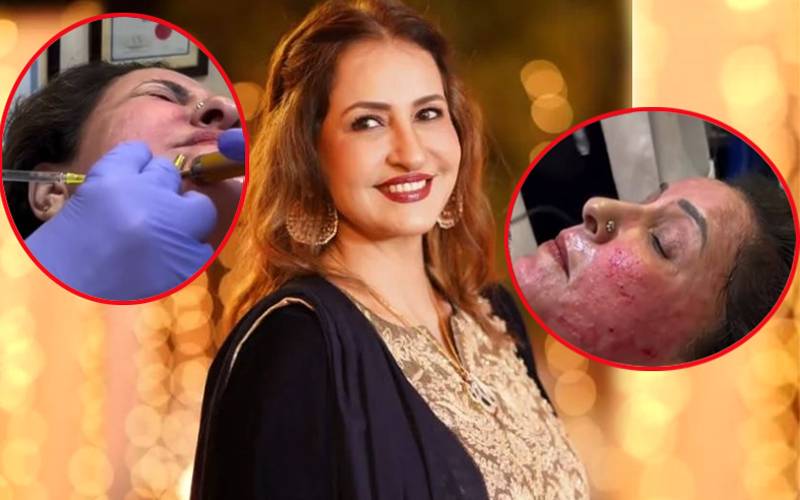 صبا فیصل کے کاسمیٹک پروسیجرز کی ویڈیوز وائرل، سوشل میڈیا پر بحث چھڑ گئی
