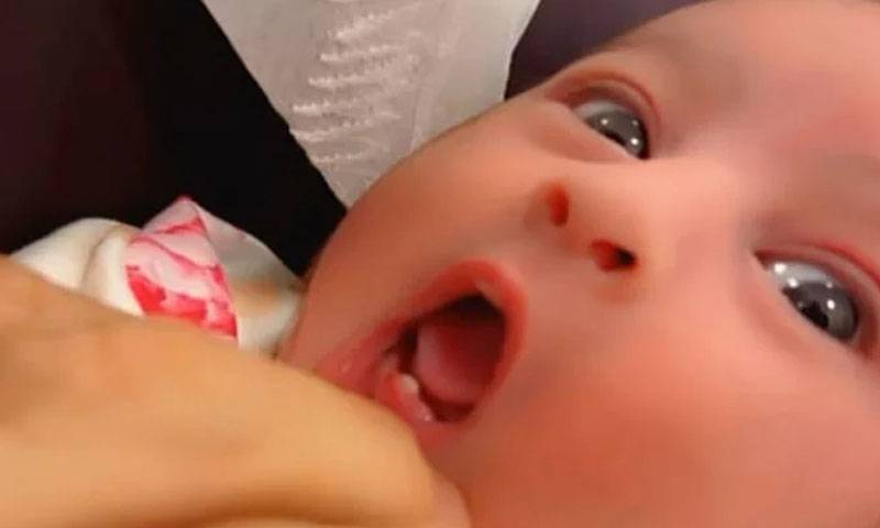 پیدائش کے 6 دن بعد ہی بچی کے دانت نکل آئے