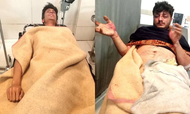 فیصل آباد: گیس سلنڈر لیکج سے آتشزدگی، 1 ہی خاندان کے 5 افراد جھلس گئے