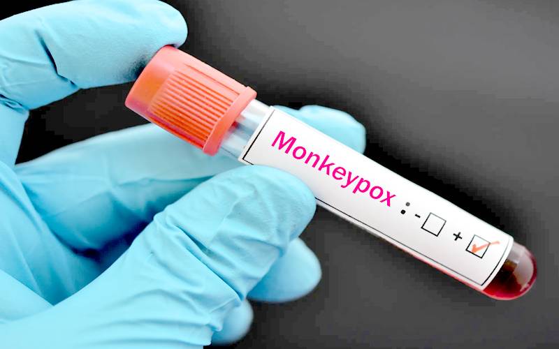 لاہور میں منکی پاکس کےدومزید کیسز،مجموعی تعداد30ہوگئی