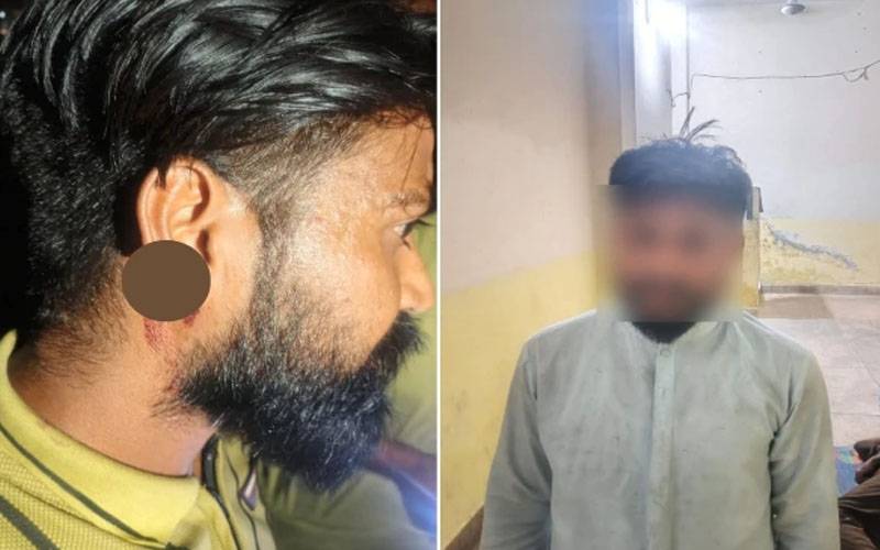  انوکھا واقعہ، گاہک نے دکاندار کا کان چبا ڈالا