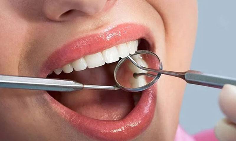مسوڑوں سے خون آنا جان لیوا مرض کی نشاندہی، تحقیق میں بڑا انکشاف 