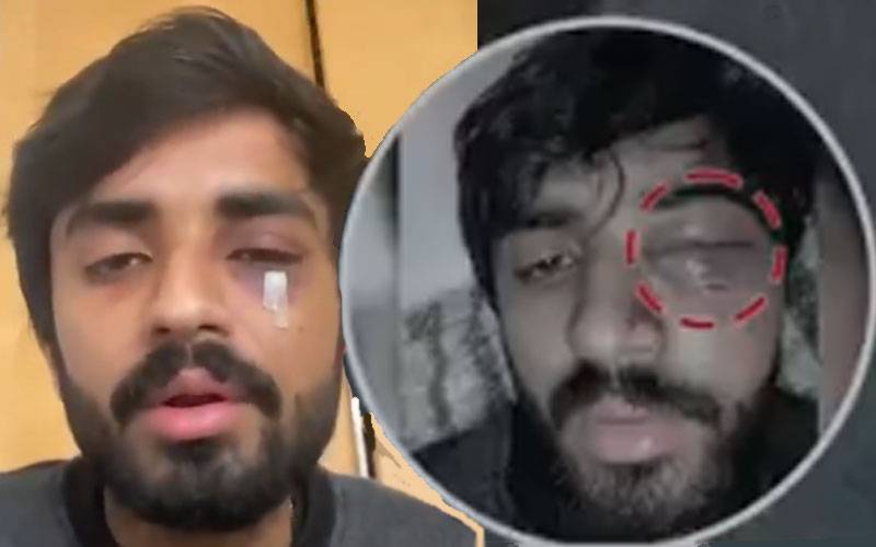 سکاٹ لینڈ میں   پاکستانی طالب علم مصدق اسماعیل پر حملے کے واقعہ کی تفصیلات سامنے آ گئیں