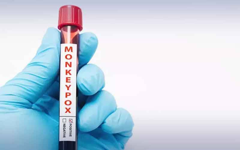 پمز میں زیر علاج  خاتون میں ایم پاکس کی تصدیق